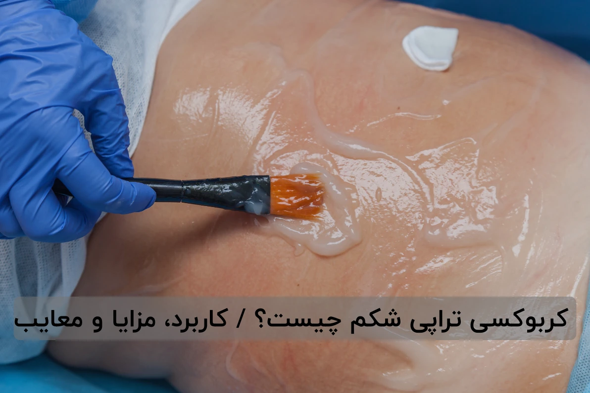 کربوکسی تراپی شکم چیست؟ / کاربرد، مزایا و معایب 